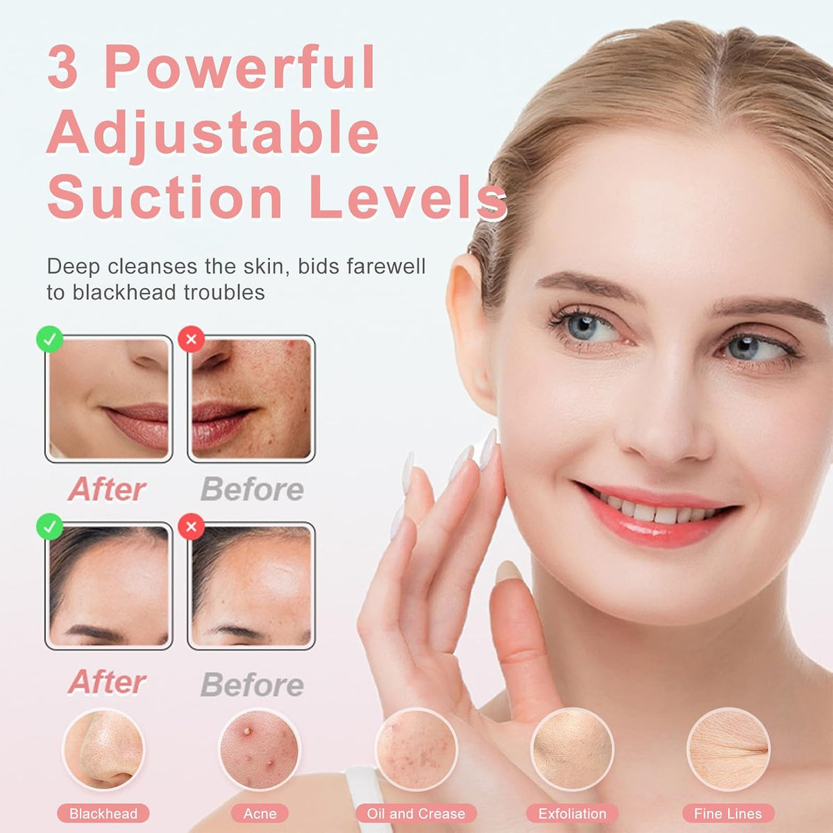 2026 Blackhead Vacuum, Pore Vacuum,Rechargeable Black Head Remover for Face